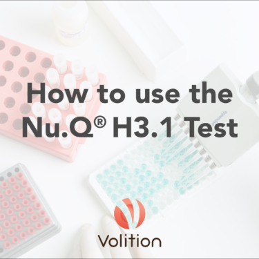 cover image for Nu.Q H3.1 Test video