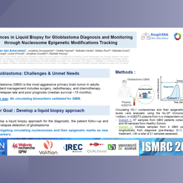Advances in Liquid Biopsy for Glioblastoma Diagnosis and Monitoring