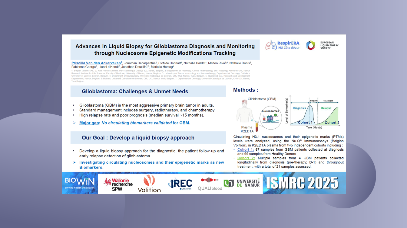 Advances in Liquid Biopsy for Glioblastoma Diagnosis and Monitoring